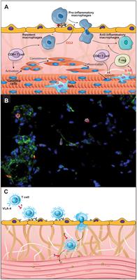 T cell biology in neuromuscular disorders: a focus on Duchenne Muscular Dystrophy and Amyotrophic Lateral Sclerosis